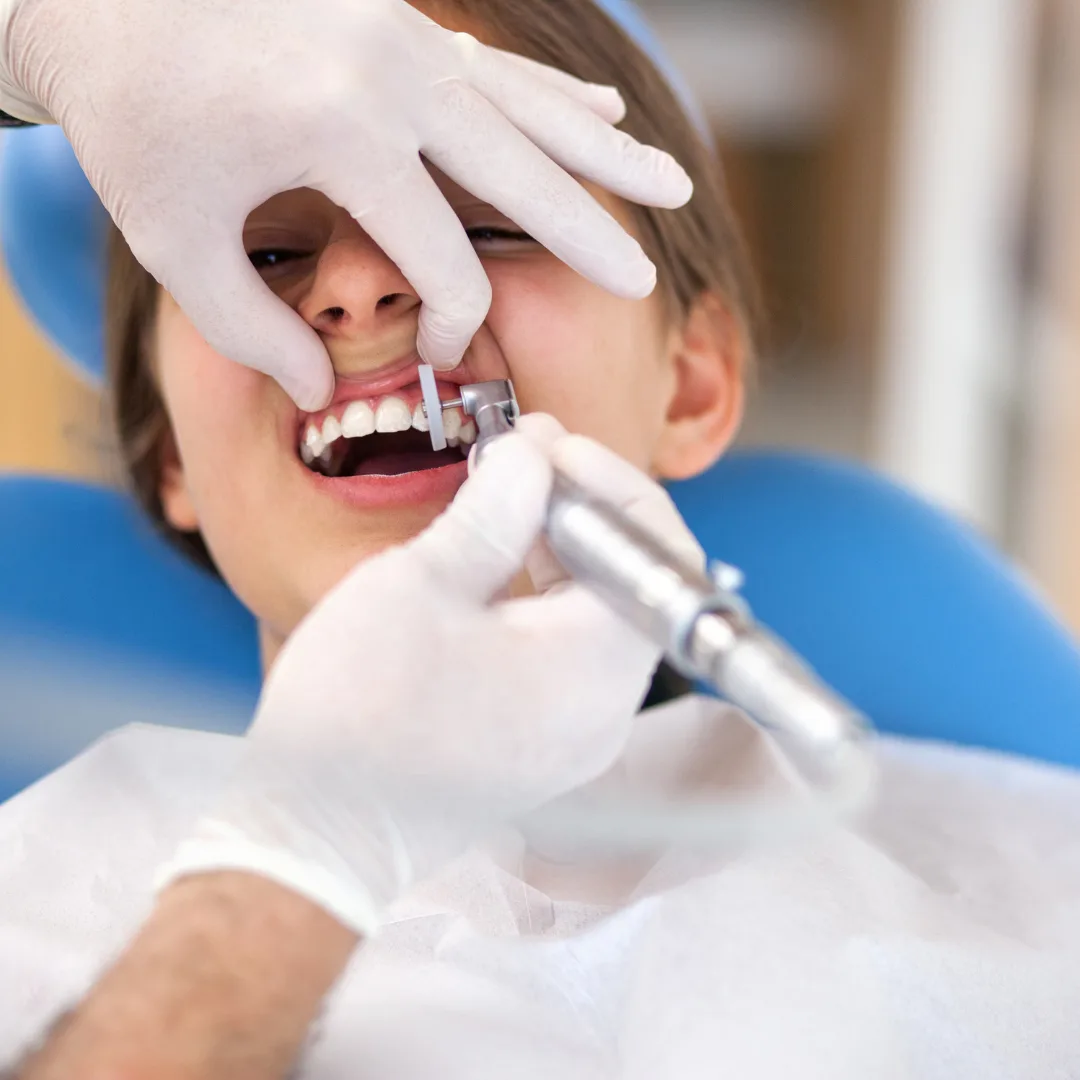 Professional dental cleaning procedure
