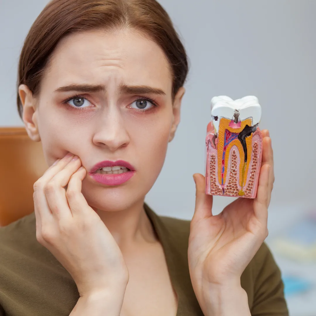 Veneer smile makeover results