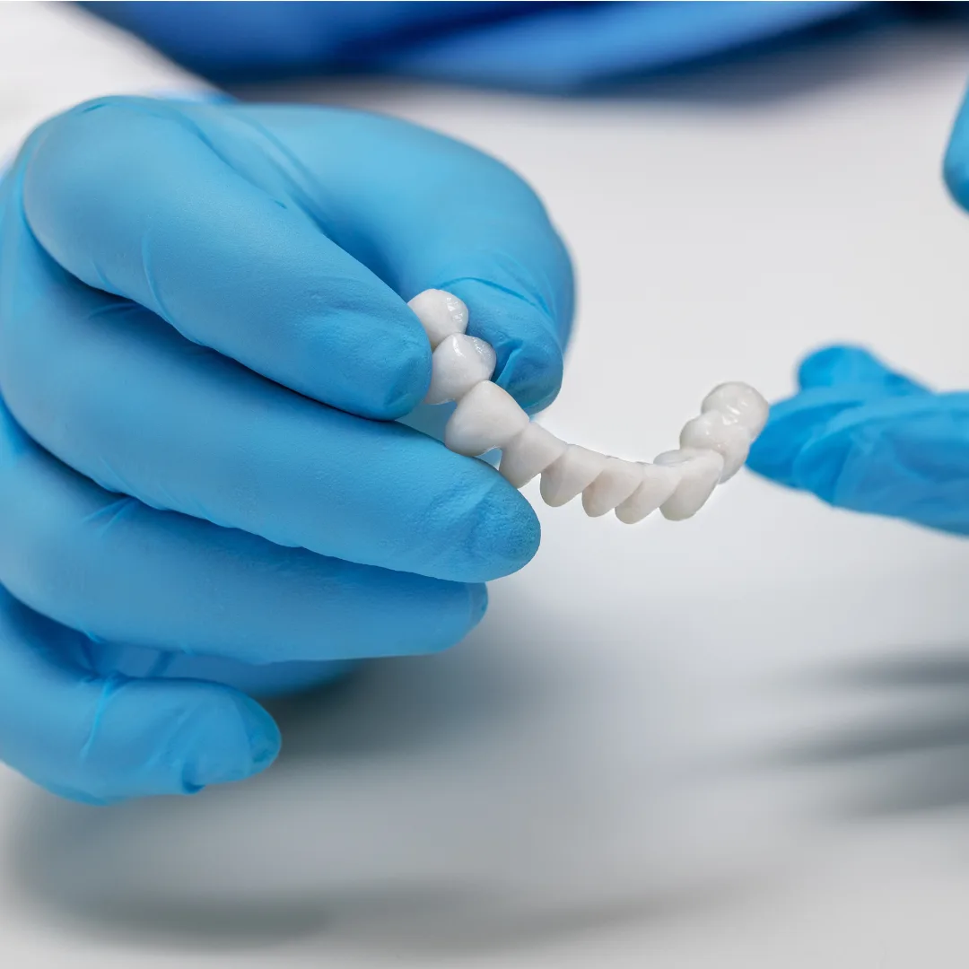 Dental crown restoration