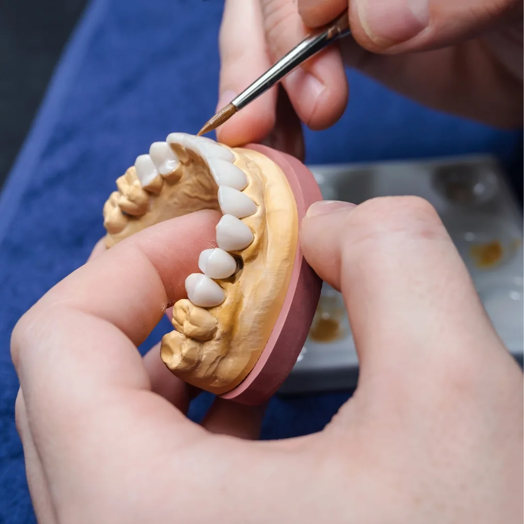 Crown and bridge results