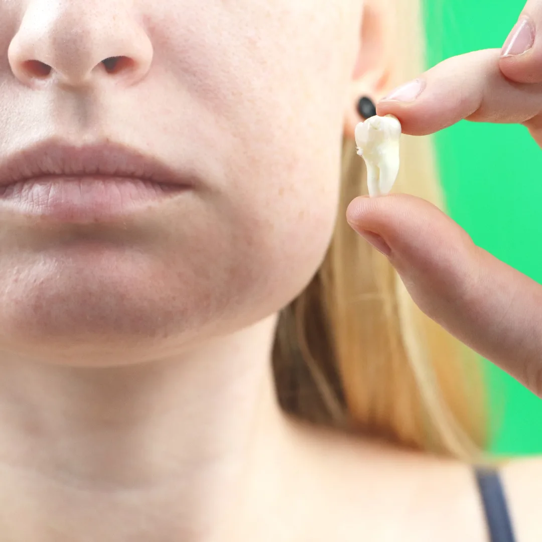 Extraction aftercare guidance