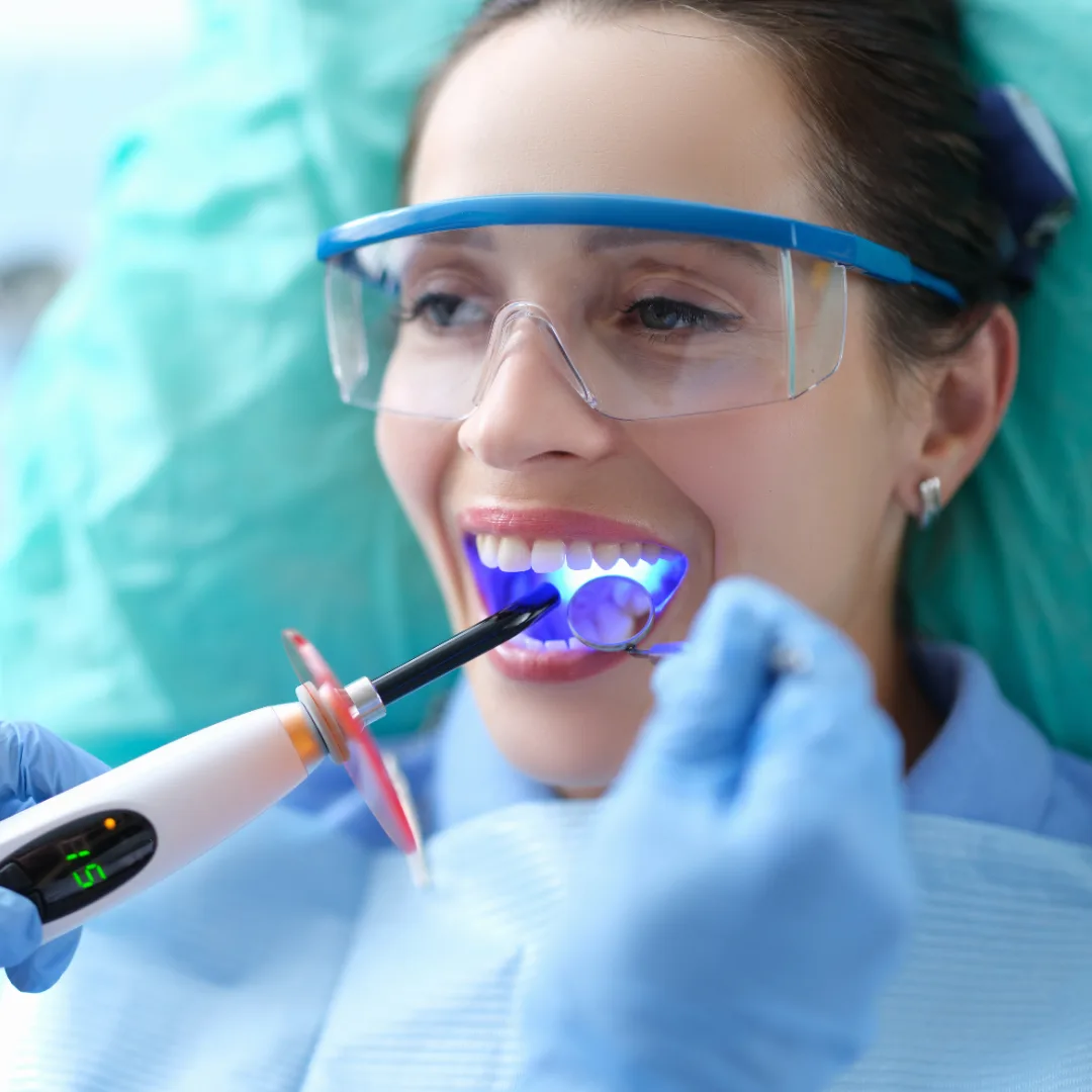 Tooth-colored composite filling