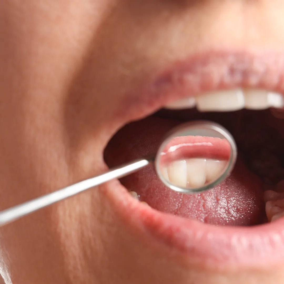 Dentist performing oral screening