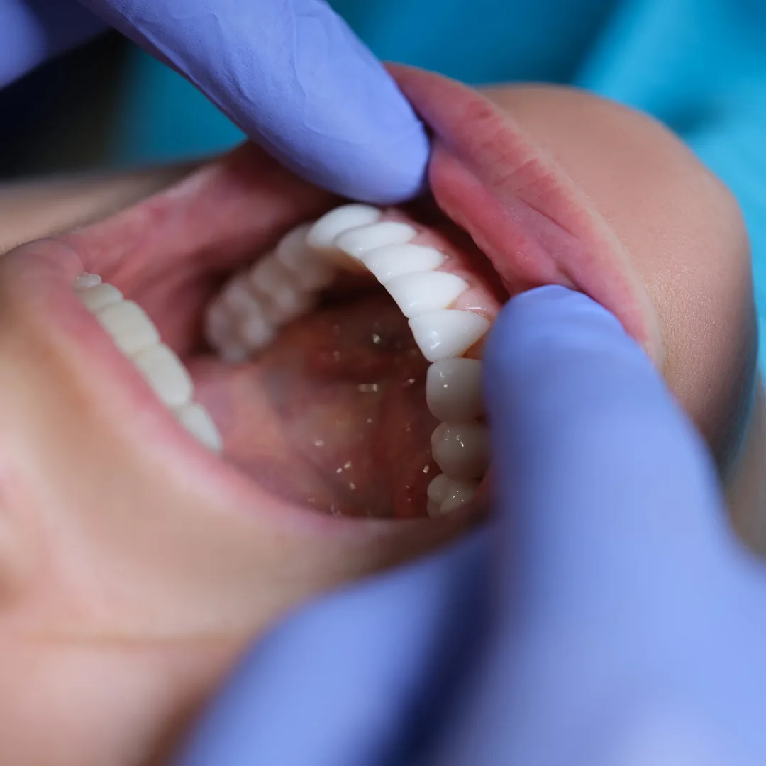 Oral cancer screening examination at Thrive Dental