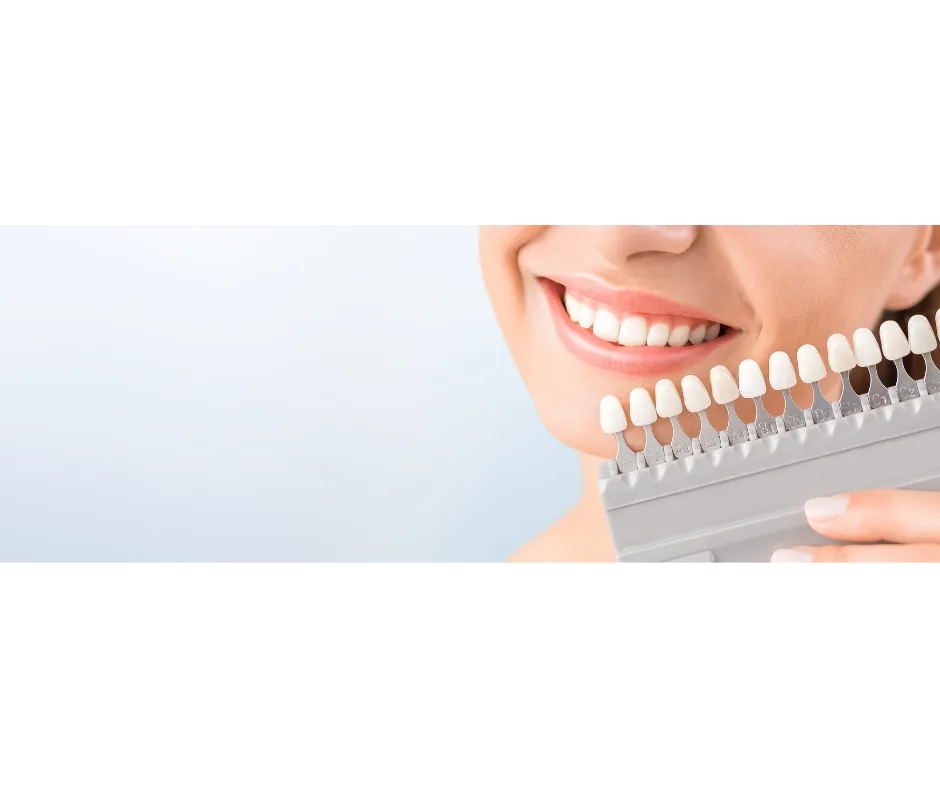 Professional teeth whitening treatment at Thrive Dental